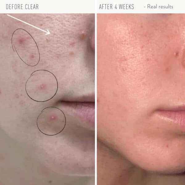Clear Serum - Image 2